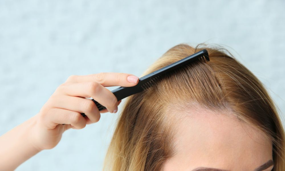 Giai đoạn đầu tiên của hành trình rụng tóc thường là một cú sốc tâm lý