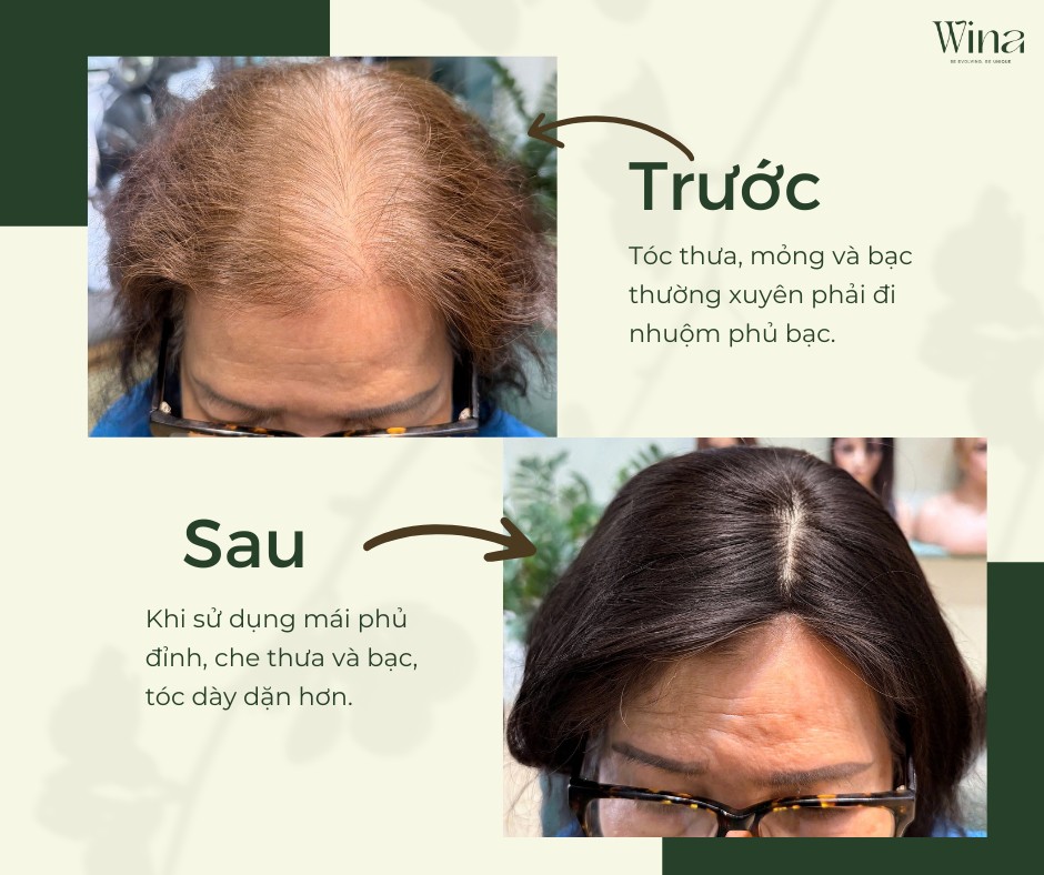 Xác định bạn sử dụng tóc giả để làm gì?