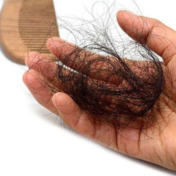 Tóc giả cho người bị rụng tóc nhiều