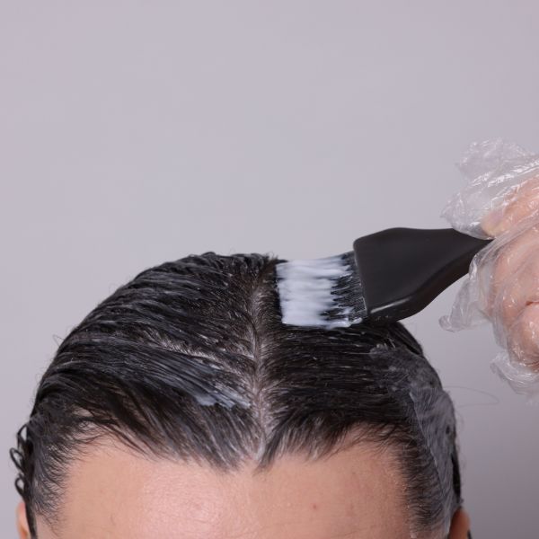 Tác hại của thuốc nhuộm tóc lâu dài không chỉ dừng lại ở việc khiến tóc khô xơ mà các thành phần như PPD, Amoniac còn có thể gây viêm da tiếp xúc, làm teo nang tóc vĩnh viễn