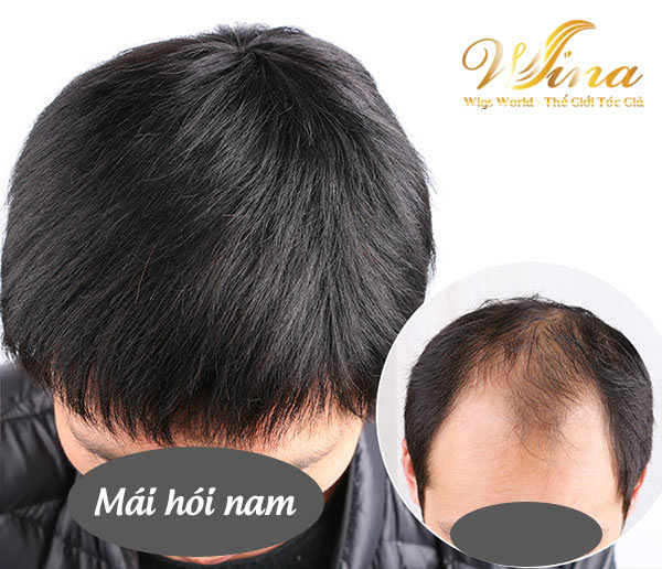 Tóc mái hói nam chữ M nam - 100% tóc thật | Shopee Việt Nam