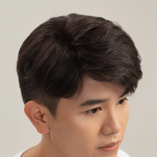 Mái hói nam tự nhiên