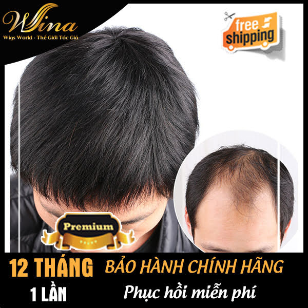 Mái Hói Nam Bằng Tóc Thật Không Da & Siêu Da Đầu TTN-01