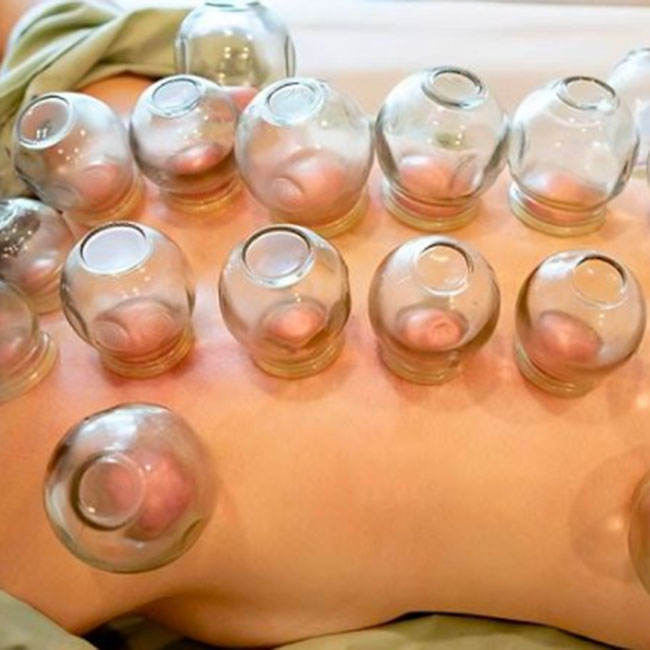 Mua bộ giác hơi cạo gió điện nào tốt? Mua ở đâu ? Hướng dẫn sử dụng máy giác hơi cạo gió như thế nào