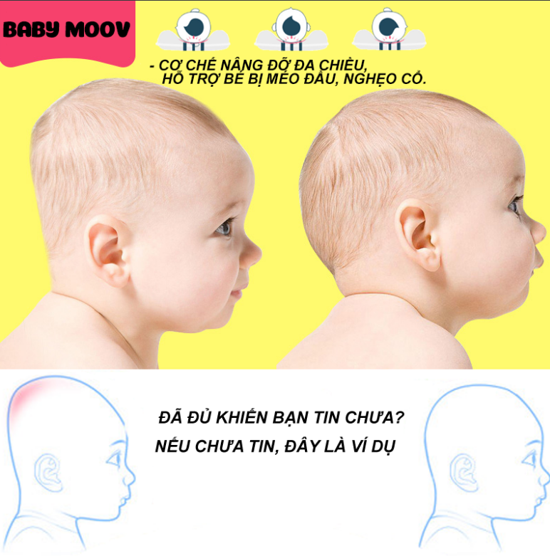 Gối chống bẹp đầu méo đầu cho trẻ sơ sinh BabyMoove Pháp