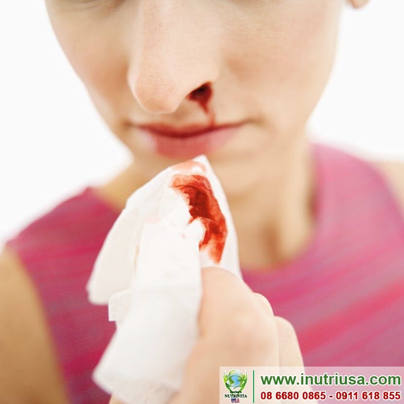 Bạn đang quan tâm làm thế nào để phòng chống ung thư?