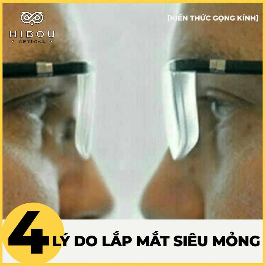 TẠI SAO NÊN LẮP MẮT KÍNH SIÊU MỎNG❓