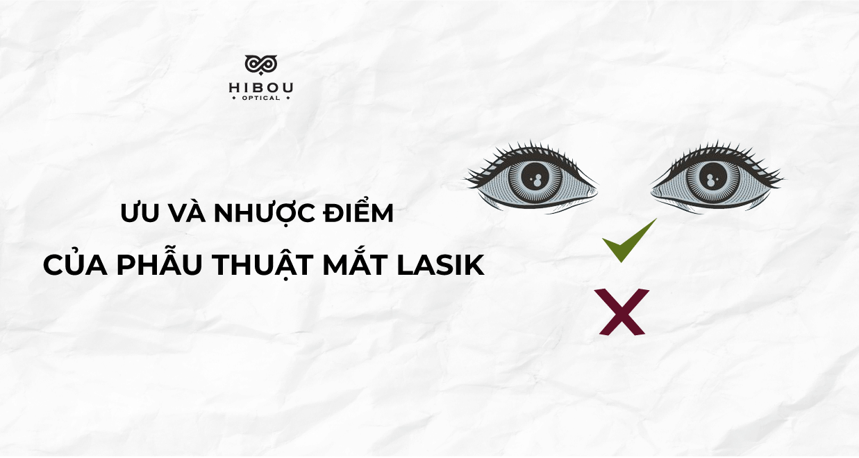 Ưu và nhược điểm của phẫu thuật mắt Lasik xoá cận