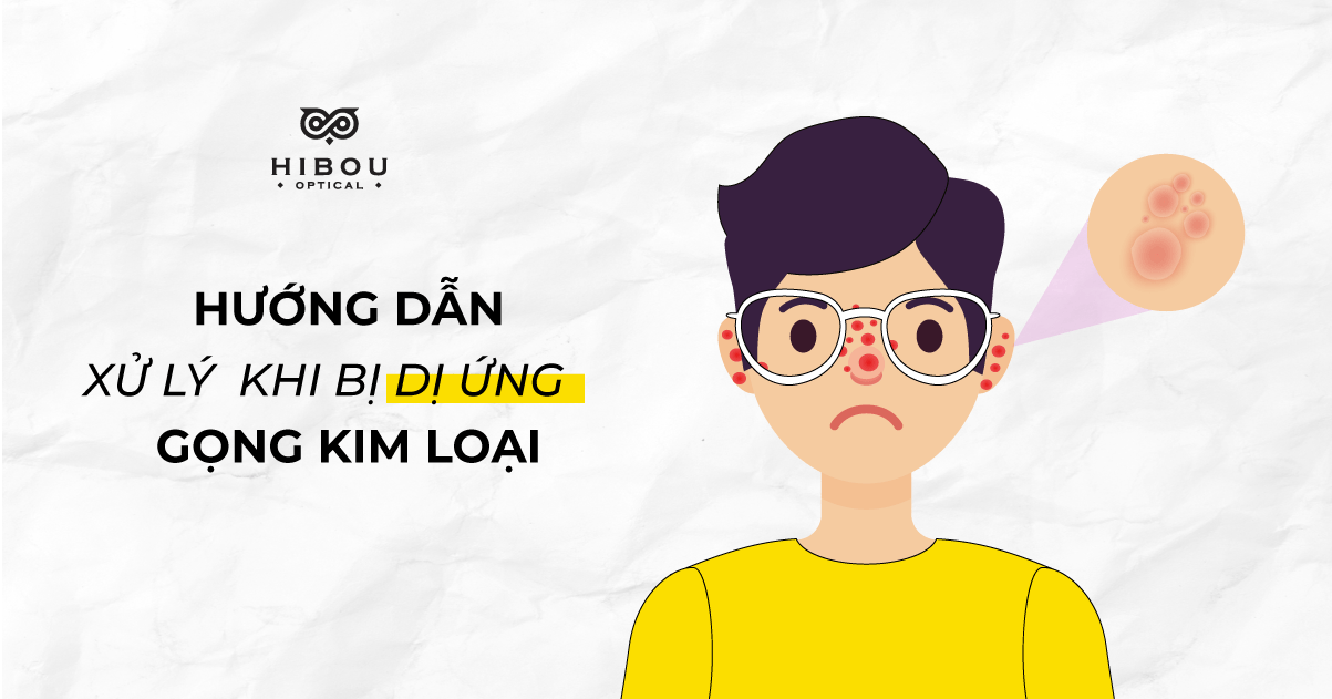 HƯỚNG DẪN XỬ LÝ KỊP THỜI KHI BỊ DỊ ỨNG GỌNG KÍNH KIM LOẠI