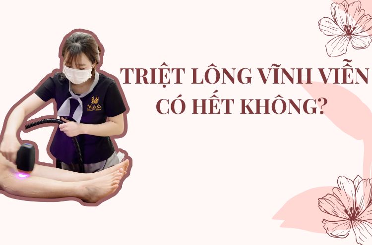 Triệt Lông Vĩnh Viễn Có Hết Không?