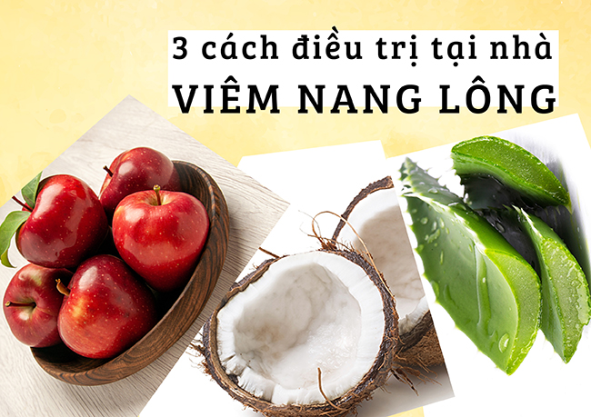 Viêm lỗ chân lông và 3 cách điều trị hiệu quả ngay tại nhà