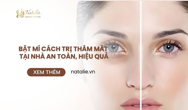 Bật Mí Cách Trị Thâm Mắt Tại Nhà An Toàn, Hiệu Quả