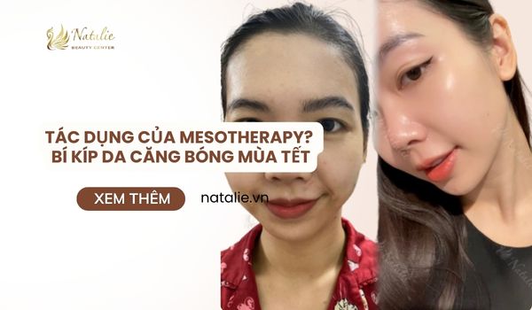 Tác Dụng Của Mesotherapy? Bí Kíp Da Căng Bóng Cho Mùa Tết