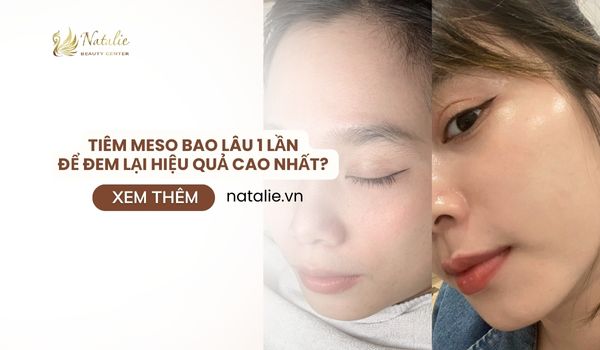 Tiêm meso Bao Lâu 1 Lần Để Đem Lại Hiệu Quả Cao Nhất? Chăm Sóc Sau Tiêm Như Thế Nào? 