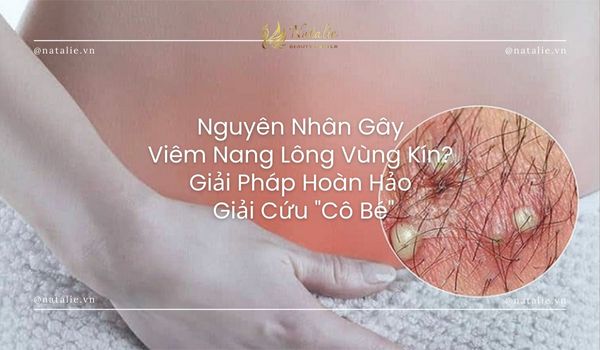 Nguyên Nhân Gây Viêm Nang Lông Vùng Kín? Giải Pháp Hoàn Hảo Giải Cứu 