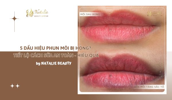 5 Dấu Hiệu Phun Môi Bị Hỏng? Tiết Lộ Cách Sửa Môi Bị Hỏng Sau Phun