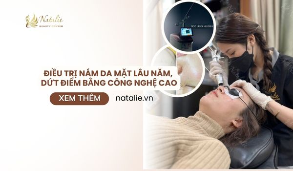 Điều Trị Nám Da Mặt Lâu Năm, Dứt Điểm Bằng Công Nghệ Cao