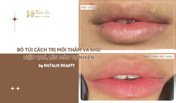 Bỏ Túi Cách Trị Môi Thâm Và Khô Hiệu Quả, Lên Màu Tự Nhiên