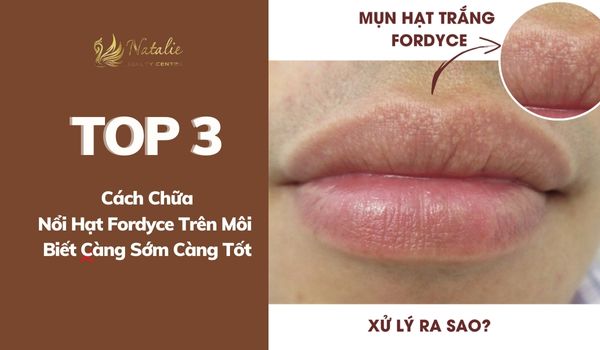 TOP 3 Cách Chữa Nổi Hạt Fordyce Trên Môi - Biết Càng Sớm Càng Tốt