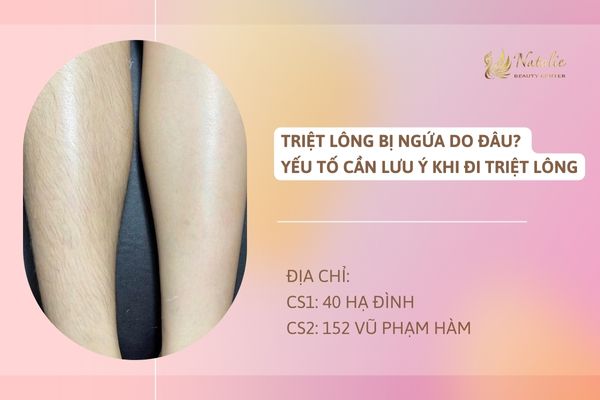 Triệt Lông Bị Ngứa Do Đâu? Yếu Tố Cần Lưu Ý Khi Đi Triệt Lông
