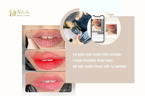 Có Nên Khử Thâm Môi Không? Chọn Phương Pháp Nào Để Môi Thâm Phục Hồi Tự Nhiên?