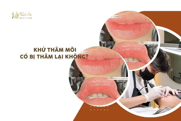 Khử Thâm Môi Có Bị Thâm Lại Không? Yếu Tố Chính Khiến Môi Dễ Bị Thâm Lại Sau Phun