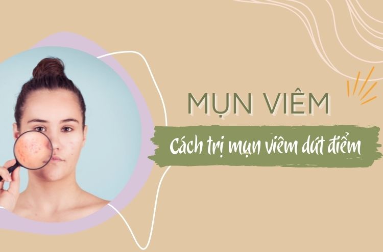 Mụn Viêm Là Gì? Mách Bạn Cách Điều Trị Mụn Viêm Dứt Điểm.