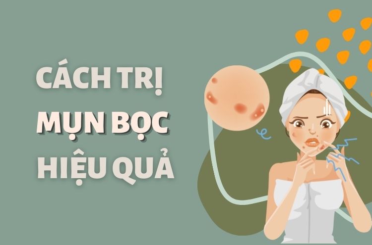 Mụn Bọc Là Gì? Cách Trị Mụn Bọc Tận Gốc Tiết Kiệm Thời Gian