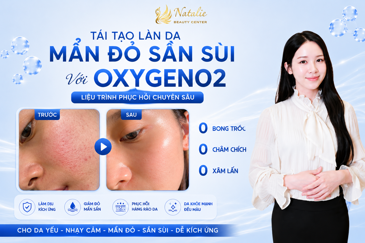 Phục Hồi Da Mẩn Đỏ Sần Sùi Với Cứu Tinh Là OXYGEN02