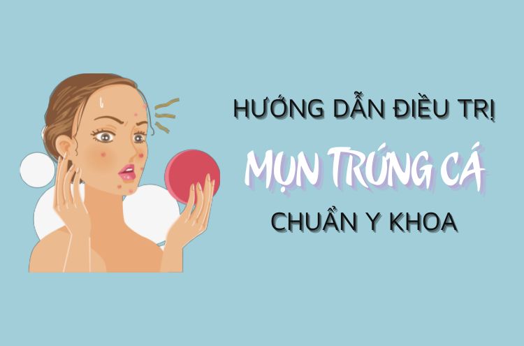 Bỏ Túi Cách Nặn Và Điều Trị Mụn Trứng Cá Chuẩn Y Khoa