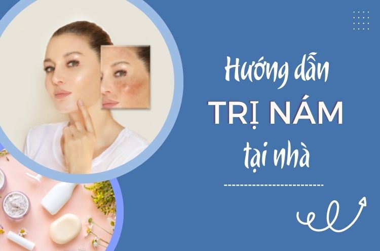 Điều Trị Nám Tại Nhà? Có Dễ Để Điều Trị Nám Không?