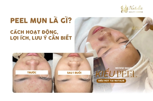 Peel Mụn Là Gì? Cách Hoạt Động, Lợi Ích và Lưu Ý Cần Biết