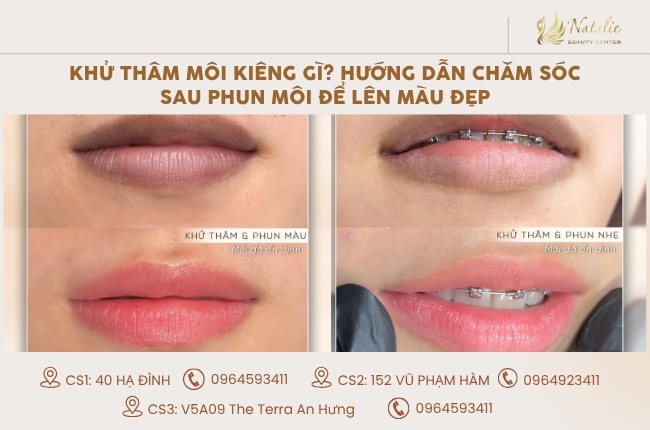 Khử Thâm Môi Kiêng Gì? Hướng Dẫn Chăm Sóc Sau Phun Môi Để Lên Màu Đẹp