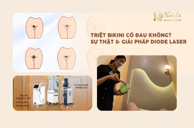 Triệt Bikini Có Đau Không? Sự Thật & Giải Pháp Giúp Bạn An Tâm