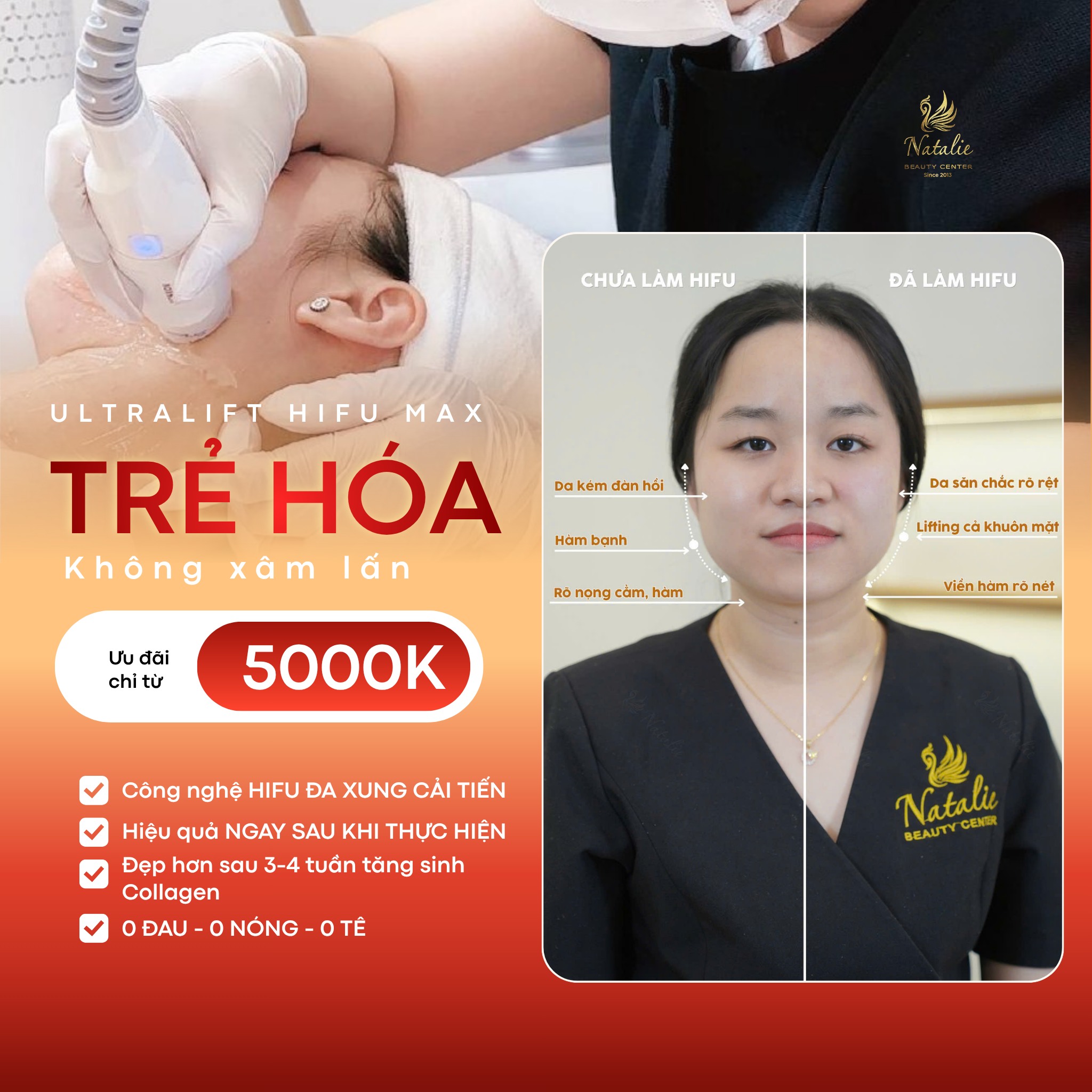 HIFU có tác dụng gì? Giải pháp nâng cơ – trẻ hóa da 0 ĐAU - 0 NÓNG - 0 CẦN TÊ tại Natalie Beauty