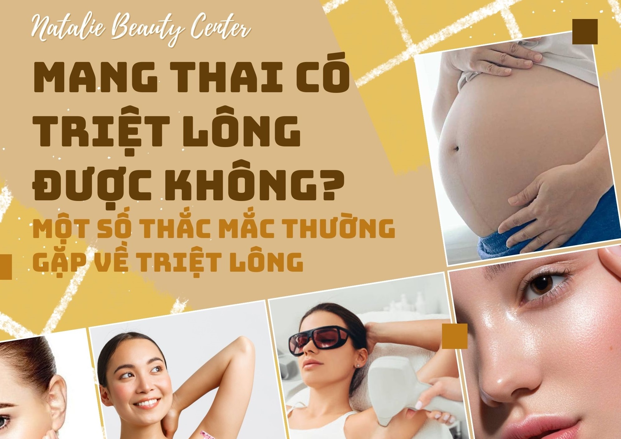 Mang thai có triệt lông được không? Một số thắc mắc thường gặp về triệt lông