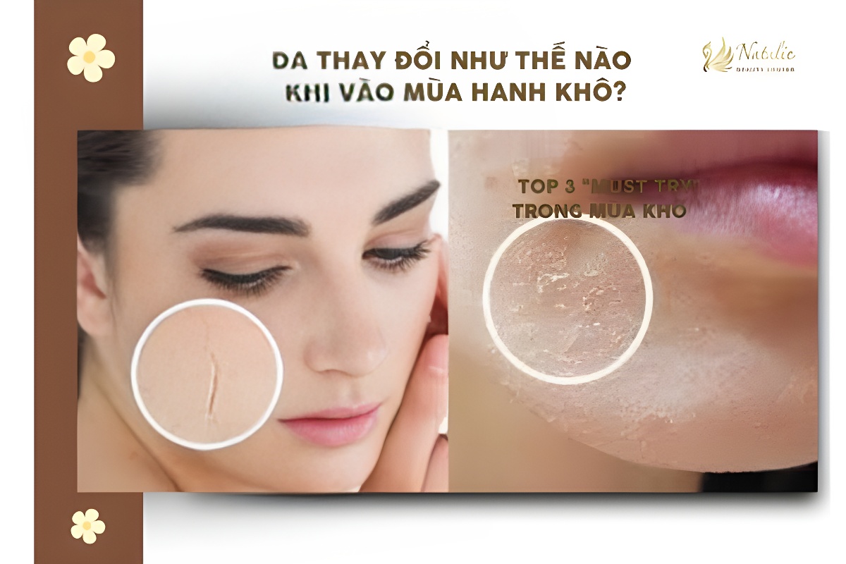 da thay đổi khô