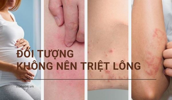 đối tượng không nên triệt lông