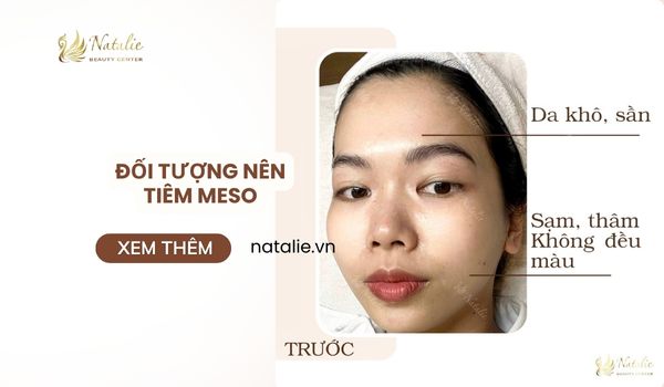 đối tượng nên tiêm meso