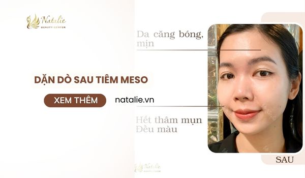 dặn dò sau tiêm meso