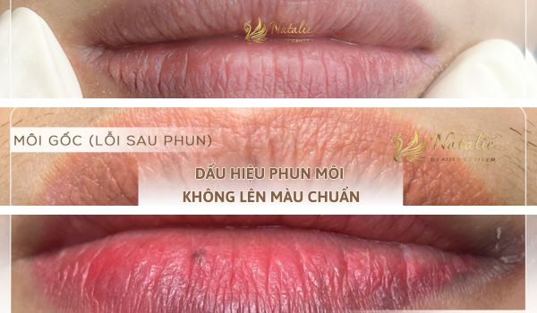 dấu hiệu phun môi lỗi