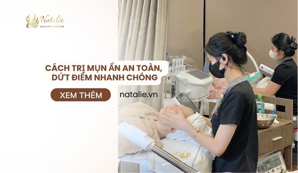 cách trị mụn ẩn an toàn