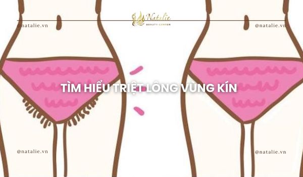 tìm hiểu triệt lông vùng kín