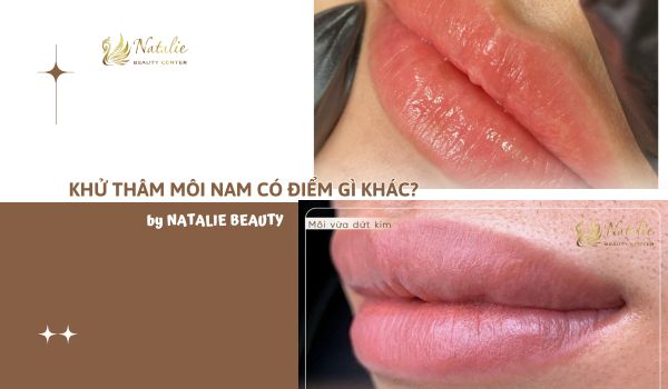 khử thâm môi nam có gì khác