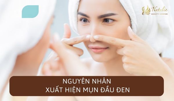 nguyên nhân xuất hiện mụn đầu đen