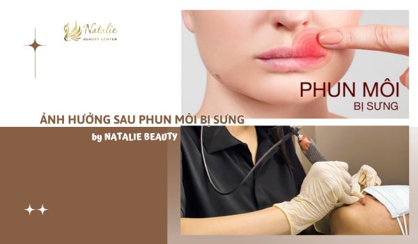 ảnh hưởng sau phun bị sưng