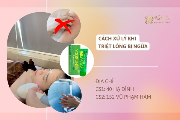 cách xử lý bị ngứa