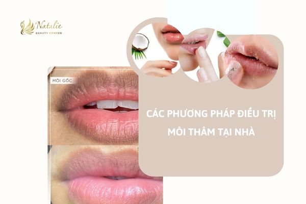 khử thâm tại nhà