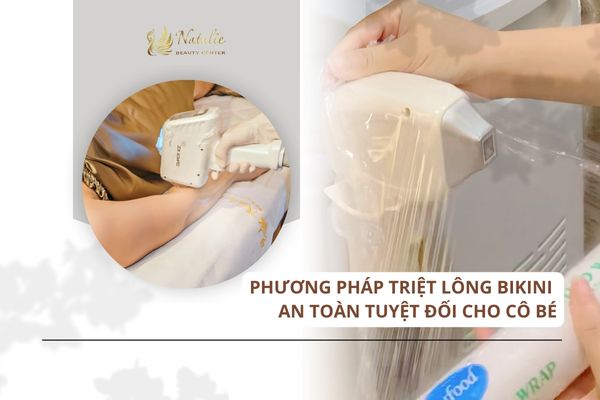 phương pháp triệt diode an toàn cô bé