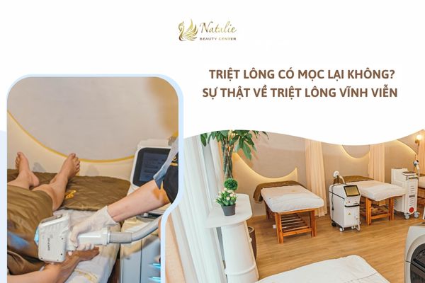 triệt lông có mọc trở lại không